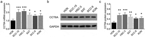 Figure 1. CCT6A expression. CCT6A mRNA expression (a) and protein expression (b, c) were increased in OSCC cells compared to control cells.