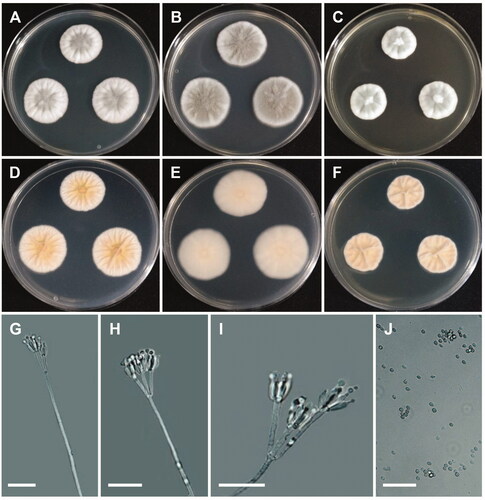 Figure 4. Morphology of Penicillium echinulonalgiovense. (A,D) Colonies on Czapek yeast autolysate agar (CYA); (B,E) Colonies on Blakeslee’s malt extract agar (MEA); (C,F) Colonies on yeast malt extract agar (YES). (A–C: obverse view, D–F: reverse view). (G–I) Conidiophores; (J) Conidia (scale bars: G–J = 20 μm).