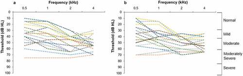 Figure 3. Individual hearing thresholds for participants (n = 19) fit bilaterally with hearing aids according to degree of hearing loss. (a): Left ear. (b): Right ear.