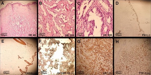 Figure 2 Histopathologic finding of scalp lesions.