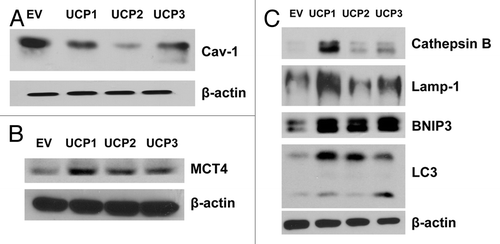 Figure 3. Overexpression of UCP1, UCP2, or UCP3 induces the downregulation of Cav-1 expression, with increased autophagy in human fibroblasts. UCP1-, UCP2-, or UCP3-overexpressing fibroblasts and vector-alone control cells (EV) were grown for 48 h in complete media. (A) Immunoblot analysis using antibodies against Cav-1. Note that UCP1 and UCP2 and, to a lesser extent, UCP3 isoforms induce the downregulation of Cav-1 expression, as compared with EV control. (B) Immunoblot analysis with antibodies directed against MCT4 shows that UCP1, UCP2, or UCP3 overexpression increases MCT4 levels. (C) Immunoblot analysis with antibodies directed against a panel of autophagy markers. Note that all three UCP isoforms induce autophagy, as assessed by upregulation of BNIP3 and LC3, relative to control fibroblasts. However, only UCP1 significantly increases the expression levels of the lysosomal/autophagy markers Lamp-1 and cathepsin B. For all, β-actin was used as equal loading control.