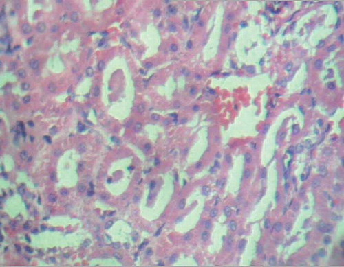 Figure 6. Cast formation within tubules (H&E staining, ×280).