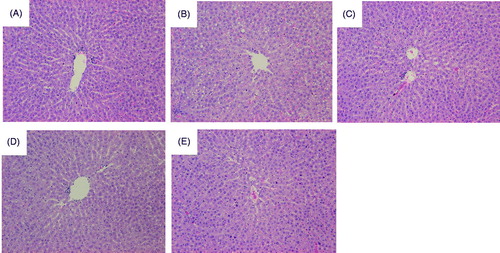 Figure 2. Representative photomicrographs of liver tissues in the control and experimental rats. (A) NC, normal control, water; (B) EC, water + ethanol-treated control; (C) PV, total concentrate of PV (100 mg/kg BW) + ethanol; (D) PI, ethanol-insoluble fraction of PV (100 mg/kg BW) + ethanol; and (E) PS, ethanol-soluble fraction of PV (100 mg/kg BW) + ethanol. The liver sections of rats from each group was stained using haematoxylin and eosin (H&E), and the images were examined by light microscopy. The arrows indicate steatosis.