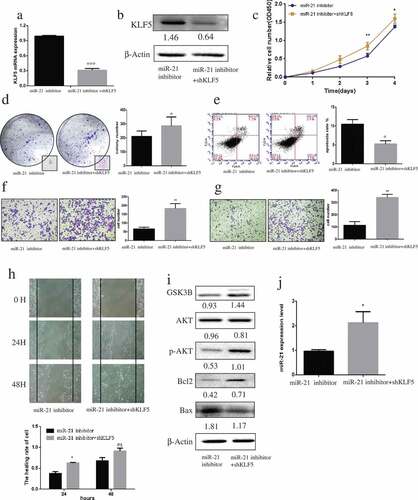 Figure 6. Downregulation of KLF5 promotes PCa carcinogenesis.