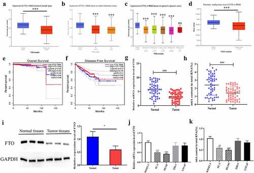 Figure 1. FTO was lowly expressed in PCa. (a). Assessment of FTO expression level in PCa tissues based on the Ualcan (http://ualcan.path.uab.edu/analysis.html) database. (b). The expression level of FTO in prostate cancer based on nodal metastasis status was obtained from the UALCAN database. (c). The expression level of FTO in prostate cancer based on patient Gleason score was obtained from the UALCAN database. (d).Assessment of promoter methylation level of FTO in PCa tissues based on the Ualcan database. (e). The associations between FTO expression and OS of PCa patients by analyzing TCGA. (f). The associations between FTO expression and DFS of PCa patients by analyzing TCGA. (g). Determination of FTO expression level in 50 pairs of PCa tissues via qRT-PCR. (h). Detection of m6A level of FTO in 50 pairs of PCa tissues via methylation. (i). Determination of FTO protein level in PCa tissues via Western blot. (j). Determination of FTO expression level in PCa cells via qRT-PCR. (k). Detection of m6A level of FTO in PCa cells via methylation. **P < 0.01; ***P < 0.001; ns no significant difference.