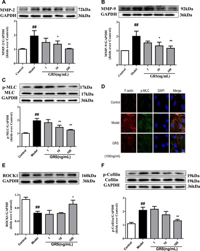 Figure 7 Effects of GRS on MMP-2/9, MLC, and ROCK/cofilin levels in OGD/R- injured bEnd.3 cells. Cells were treated with GRS (1–100 ng/mL) prior to 6 h of OGD and 18 h of reoxygenation. (A) Quantitative analysis of MMP-2 and (B) MMP-9 levels via Western blot. Band intensities were assessed via scanning densitometry and data normalized against GAPDH. Cells were treated with GRS (1–100 ng/mL) before 6 h of OGD in a hypoxic chamber and subjected to reoxygenation for 1 h. (C) Western blot analysis of phosphorylated MLC. (D) Confocal immunofluorescent images of F-actin (red), p-MLC (green) and nuclei (blue) in bEnd.3 cells. Scale bar = 20 µm. ROCK1 (E) and p-cofilin (F) levels were quantitatively analyzed via Western blot. Data are expressed as means ± SD, n = 3. ##P < 0.01 vs Control; *P < 0.05 vs Model; **P < 0.01 vs. Model.