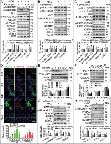 Figure 3. AMPK mediates autophagy in Leydig cells (LCs) upon the HsCG challenge. (A-C) TM3 cells were pre-treated with rapamycin (100 μM), compound C (1 μM) or SBI-0206965 (2 μM) for 1 h followed by exposure to HsCG for 6 h. The cell extracts were subjected to western blotting and quantitative analysis. Data are presented as means ± SEM (n = 3). *P < 0.05 vs. the control cells; #P < 0.05 vs. the HsCG-treated cells. (D) The expression of p-PRKAA2 in LCs at different developmental stages was examined by immunofluorescence staining. Fluorescence intensity was presented as means ± SEM (n = 3). *P < 0.05 vs. post-natal days 10 (D10) group. (E) TM3 cells were treated with HsCG for indicated times. The cell extracts were subjected to western blotting and quantitative analysis. Data are presented as means ± SEM (n = 3). *P < 0.05 vs. the control cells. (F) Protein levels of PPM1A, STK11/LKB1, and CAMKK2 in LCs at different developmental stages were analyzed by western blotting. *P < 0.05 vs. D10 group. (G and H) TM3 cells were transfected with siRNA targeting Camkk2 (si-Camkk2) or pcDNA3.1-Ppm1a vector (O/E Ppm1a; O/E, overexpression) for 36 h followed by exposure to HsCG for 6 h. The cell extracts were subjected to western blotting and quantitative analysis. Data are presented as means ± SEM (n = 3). *P < 0.05 vs. the control cells; #P < 0.05 vs. the HsCG-treated cells