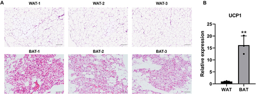 Figure 1 H&E staining and UCP1 expression in BAT and WAT. (A) BAT and WAT were stained with H&E, scale bar 200μm. (B) UCP1 mRNA expression of BAT and WAT. n=3, **p<0.01.