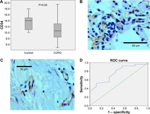 Figure 4 Endobronchial mucosal microvasculature in COPD and controls.