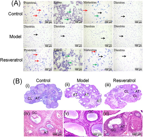 Figure 3. Effects of resveratrol treatment on estrous cycle and ovarian morphology in PCOS rats. (A) Estrous cycle of the control rats, PCOS rats, and resveratrol-treated PCOS rats was determined by vaginal cytology. (B) Ovary morphology of the control rats, PCOS rats, and resveratrol-treated PCOS rats was evaluated by H&E staining. AT = atretic follicle; CL = corpus luteum; GC = Granular cells.