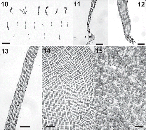 Figs 10–15. Prasiola fluviatilis. Fig. 10. Habit. Fig. 11. Basal part of a specimen showing uniseriate rhizoids. Fig. 12. Detail of the basal portion of a specimen. Fig. 13. Detail of blade with ribbon-like habit. Fig. 14. Surface view of blade showing evident areolae. Fig. 15. Detail of apical part of a blade with presumptive gametangial portions. Scale bar: Scale bars: Fig. 10=1 cm; Figs 11–15=40 μm.