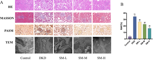 Figure 11 (A) SM ameliorated renal pathological damage in DKD rats. Light microscopy (HE, MASSON and PASM staining, 400×) and TEM (15,000×) of kidney tissues from DKD rats; (B) relative area fibrosis quantification(RAF) by MASSON.** P < 0.01, compared with the control group; ## P < 0.01, compared with the DKD group.