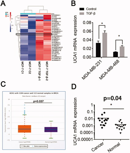 Figure 2. TGF-β promotes UCA1 expression. (A) MCF-7 cells were incubated with either a vehicle or TGF-β (10 ng/mL) for 24 h. A series of LncRNAs associated with chemoresistance was detected by qRT-PCR. (B) UCA1 expression in the MDA-MB-231 and MDA-MB-468 cell lines following TGF-β1 stimulation. (C) UCA1 expression in BC by Starbase. (D) The level of UCA1 mRNA expression in BC patients.