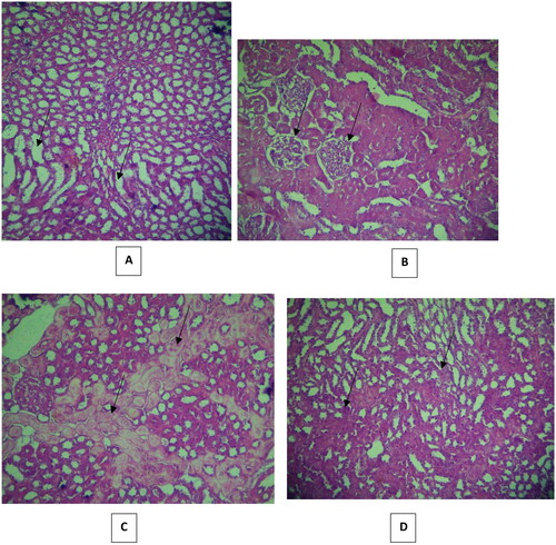 Figure 8. Effect of vitamin D3 (500 IU/Kg) on histopathological changes in histopathological changes in (300 mg/kg) dose vancomycin-induced renal injury in rats. (A, B, C and D: group C: hematoxylin and eosin ×40). In (A) Mild tubular dilatation and vacuolization tubules, (B) partial injury to the renal glomerular, (C) partial hyaline dystrophy and (D) Less distribution of leukocytes.