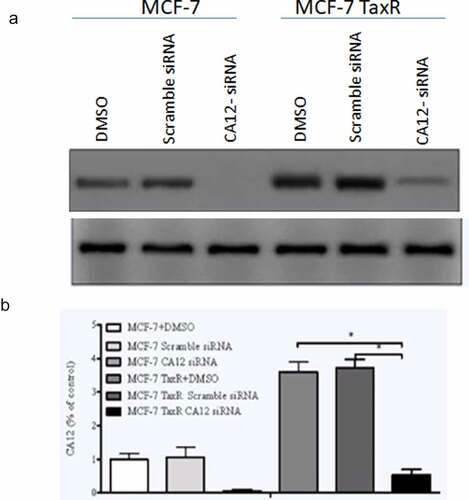 Figure 2. Effects of siRNA transfection on the expression of CA12 protein in MCF-7 and MCF-7 TaxR cells (n = 3). (a)The expression of CA12 protein in MCF-7 and MCF-7 TaxR cells after siRNA transfection; (b) The relative expression of CA12 protein in MCF-7 and MCF-7 TaxR cells after siRNA transfection. *: Compared with the two control groups (blank+negative), P < 0.05