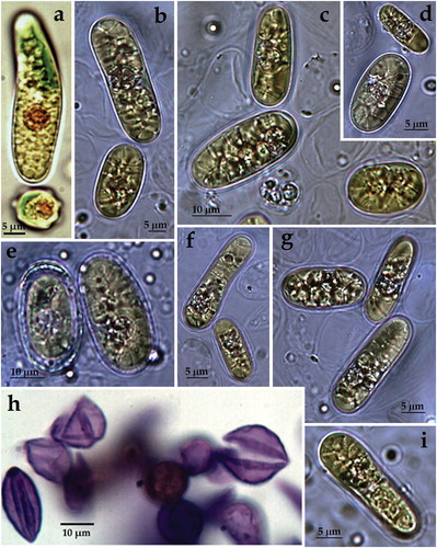 Figure 3. LM microphotographs of strain ACUS 00024 from culture material in 2007–2009 (a, h) and in May 2018 (b–g, i).Note: Scale bar is indicated on each microphotograph.