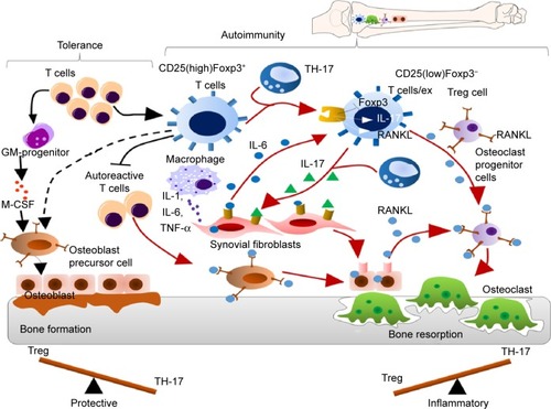 Figure 1 The mechanism of balance between tolerance and autoimmunity at the site of arthritic joint inflammation.Notes: During autoimmune arthritis, the naturally occurring CD25(high)Foxp3+ T regulatory cells convert into CD25(low)Foxp3− T regulatory cells by losing Foxp3 expression. IL-6 and IL-17 secreted by the synovial fibroblasts induce the conversion of this subset of T regulatory cells into pathogenic TH-17 cells. Like synovial fibroblasts and osteoblasts, TH-17 cells derived from Foxp3+ T cells can produce high levels of RANKL, which directly promote osteoclastogenesis/bone resorption/destruction.Abbreviations: GM, granulocyte–macrophage; M-CSF, macrophage colony-stimulating factor; IL, interleukin; TH, T helper; TNF-α, tumor necrosis factor alpha.