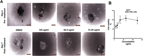 Figure 7 The effect of C. siphonella on the 3D culture of MCF-7. (A) Representative images show the spheroid shape of MCF-7 before and after being treated with C. siphonella extract at different doses 125 ug/mL, 62.5 ug/mL and 31.25 ug/mL. Scale bar 200mm. (B) Graphical presentation represents the percentage of cell viability. Data are displayed as mean ± SD.