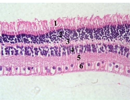 Figure 5 Photomicrograph of a section in a control rabbit’s retina showing photoreceptors layer (1), outer nuclear layer (2), outer reticular layer (3), inner nuclear layer (4), inner reticular layer (5), and ganglion cell layer (6). Hematoxylin and eosin staining, 400×.