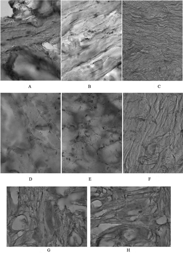Figure 2. Microstructure of the control samples of raw material, lens × 20 (A and B); × 40 (C); the PM microstructure after hydrolytic treatment, lens × 20 (D and E); × 40 (F); the PM microstructure after freeze-drying (G and H are different layers), lens × 20.
