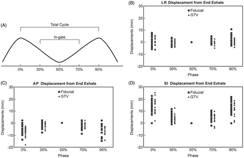 Figure 1. (A) Respiratory cycle definitions, fiducial displacements (square symbols, each phase) and gross tumor volume (GTV) displacements (triangle symbols) from end-exhalation position in (B) left-right (LR), (C) anterior-posterior (Ant-Post), and (D) superior-inferior (Sup-Inf) directions at different breathing phases for all fiducials and GTVs. Each symbol in a phase represents one patient. Positive sign indicates posterior motion in Figure C and inferior motion in Figure D.