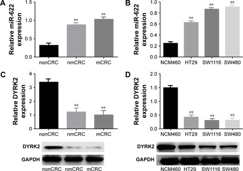 Figure 1 Elevated expression of miR-622 but depressed DYRK2 in colorectal cancer tissue and cell lines. (A) miR-622 expression in 20 cases of CRC tissues with metastasis (mCRC) and 20 cases of CRC tissues without metastasis (nmCRC) was higher than in non-cancerous tissues (nonCRC) as measured by using real time PCR. **P<0.01 vs non-cancerous tissues. (B) The expression of miR-622 was increased in three CRC cell lines (HT29, SW1116, and SW480) compared to normal human colon epithelial cell line NCM460, detected by using real time PCR. **P<0.01 vs NCM460. (C, D) Depressed expression of DYRK2 was shown in CRC tissues (mCRC and nmCRC) compared to non-cancerous tissues (nonCRC) (**P<0.01 vs non-cancerous tissues) and in three CRC cell lines (HT29, SW1116, and SW480) compared to normal human colon epithelial cell line NCM460 (**P<0.01 vs NCM460), detected by using real time PCR and Western blot. All the data are shown as mean ± standard deviation. (E) A gradual decline of DYRK2 expression at four different clinical stages was shown by IHC staining, at two magnifications (100× and 200×). (F) Analysis of correlation between the expression of miR-622 and DYRK2 in CRC tissues (two tailed Pearson’s correlation analysis, r=0.7703, **P<0.01) by detecting the mRNA expression.