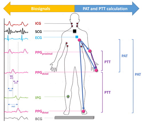 Figure 2. Relationship of pulse arrival time (PAT), pre-ejection period (PEP), and pulse transit time (PTT) on electrocardiogram (ECG), impedance cardiograph (ICG), and photoplethysmography (PPG) at proximal and distal measurement sites.Modified from Hu et al [Citation78].