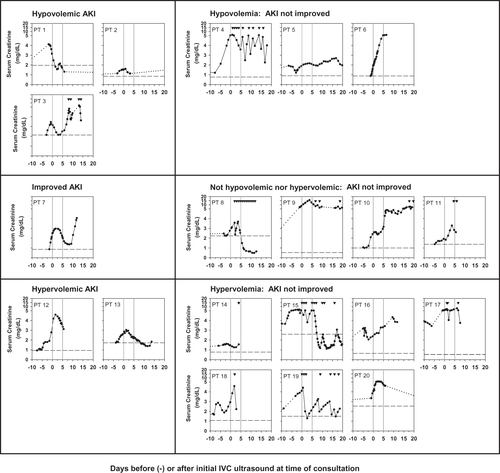 Figure 2. Changes in serum creatinine levels over time related to intravascular volume status categorized by IVC US as hypovolemia, not hypovolemia nor hypervolemia, or hypervolemia. Standardized albumin administration had been given with discontinuation of diuretics prior to initial IVC US assessment in all 20 patients. The phrase ‘AKI not improved’ means failure of serum creatinine to improve with volume management after the initial IVC US or requirement for HD therapy and thus HRS-AKI could not be excluded as a diagnosis. Patient numbers correspond to those in Table 2. Hypovolemia: IVC CI ≥50% or IVCmax ≤0.7 cm; not hypovolemic nor hypervolemic: IVC CI ≥20–<50% and IVCmax >0.7 cm; Hypervolemia: IVC CI <20% and IVCmax >0.7 cm. Solid lines connect serum creatinine values during hospital admissions, including the time when the initial IVC US was performed. Dotted lines connect serum creatinine values spanning an interval in which values were not available. Solid downward triangles at the top of the graphs indicate time(s) of intermittent hemodialysis or continuous venovenous hemodiafiltration. The Y-axis indicates the linear serum creatinine values from 0 to 5 mg/dL and from 5 to 20 mg/dL. The two vertical lines indicate the time of the initial IVC US and day five of subsequent follow-up. The dashed horizontal line in each panel indicates the baseline serum creatinine within 3 months prior to the consultation. Abbreviations: AKI: acute kidney injury; IVC US: inferior vena cava ultrasound; PT: patient.