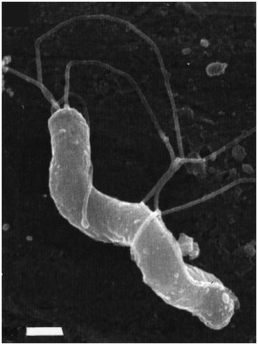 Figure 1. Morphology of H. pylori. Field-emission scanning electron microscopic (FESEM) image of a spiral-shaped H. pylori with five to seven sheathed polar flagella. The scale bar is 0.5 μm. This figure is reprinted from references (O’Rourke Citation2001; Reshetnyak and Reshetnyak Citation2017) with kind permission from the publishers.