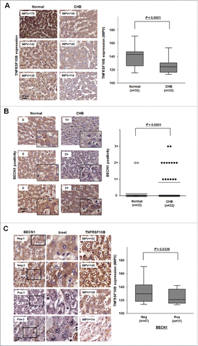 Figure 6. Expression level of TNFRSF10B is inversely related to autophagy activity in liver tissues of CHB patients. (A) Representative immunohistochemical images of TNFRSF10B expression in tissues of normal subjects and CHB patients (upper part) and relative levels of the TNFRSF10B protein (lower part). Paraffin-embedded sections of liver tissue arrays (healthy controls, n = 32; CHB patients, n = 32) were stained with anti-TNFRSF10B antibody. The expression levels of TNFRSF10B are shown as the inverted median pixel value (IMPV) as described in Fig. S1. (B) Representative immunohistochemical images of BECN1 staining (upper part) and analysis of BECN1 positivity (lower part) in CHB liver tissues. Paraffin-embedded sections of the same tissue arrays as in (A) were stained with anti-BECN1 antibody. BECN1 positivity was analyzed as described in the Materials and Methods. (C) Inverse relationship between BECN1 positivity and TNFRSF10B expression levels in clinical liver tissues. TNFRSF10B expression levels in BECN1-positive (n = 19) or -negative (n = 45) tissues were analyzed as described in the Materials and Methods. Representative immunohistochemical images (left) and relative TNFRSF10B expression (right) are shown. Data were obtained from 3 independent experiments and the P-values were obtained by Student t test.