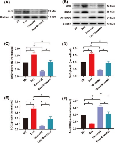 Figure 6. Western blotting and quantitative analysis of protein expression of myocardial Nrf2/Sirt3/SOD2 signaling pathway. (A) and (B) The expression of myocardial nuclear-Nrf2, Sirt3, SOD2 and Ac-SOD2 measured by western blotting (n = 3); (C)–(F) Quantitative analyses of myocardial nuclear-Nrf2, Sirt3, SOD2 and Ac-SOD2. Date was expressed as the mean ± SEM. *P < .05.