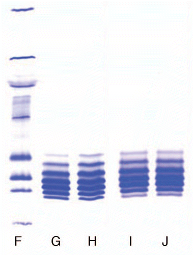 Figure 2 Comparison of isoforms of the IgG1 product prepared with Process 3 in two locations. (F) Marker; (G) Lot 1, Location 1; (H) Lot 2, Location 2; (I) Lot 3, Location 1; (J) Lot 4, Location 4.