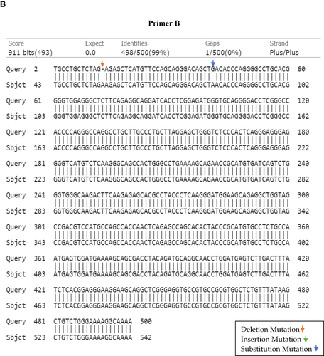 Figure 3 DNA sequencing for autistic sample 5 (Primer A and B of TBX1) revealed mutations in many regions at target sequences. (A) For primer A, there are 12 bases deletion,14 bases insertion, and 58 substitution mutations. (B) For primer B, there is one base deletion and one substitution mutation.