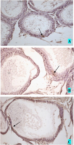 FIGURE 3 Apoptotic cells in the epididymal epithelium. A. caput, B. corpus and C. cauda epididymis. Magnification (×200).