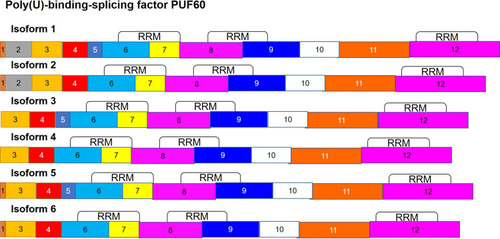 Figure 4 Alternate splicing of Poly(U)-binding-splicing factor (PUF60). The puf60 mRNA is alternately spliced to give rise to 6 isoforms. Isoforms lacking exon 2 are found to be expressed at higher levels in cancer.
