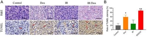 Figure 6 Histological analysis of tumors after different formulations. (A) H&E and TUNEL staining of tumors from mice after treatment with PBS, DOX, IR and IR/DOX (scale bar, 50 μm). (B) Relative rate of TUNEL staining for the different treatment groups. Data represented mean ± SD. Compared with controls: *P < 0.05, **P < 0.01.
