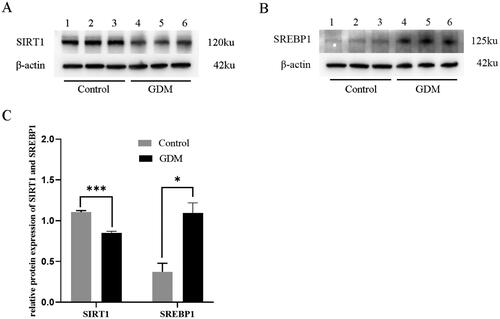 Figure 2. Relative protein expression of SIRT1 and SREBP1 in control and GDM groups. (A) Western blot detection of SIRT1 protein expression levels in placental tissues. (B) Western blot detection of SREBP1 protein expression levels in placental tissues. (C) SIRT1 and SREBP1 were significantly differentially expressed in the placental tissues of the two groups.