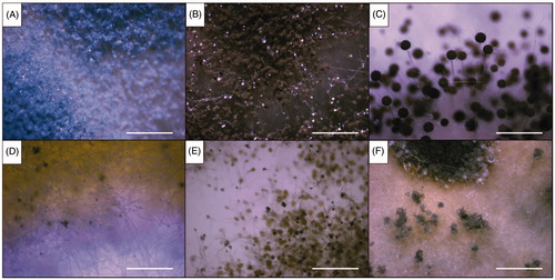 Figure 3. Dissecting microscopic images of the six representative isolates from this study (scale bars = 1 mm). (A) Isolate of sampling spot3, Penicillium sp1 DUCC6000; (B) Isolate of sampling spot1, Cladosporium sp.1 DUCC6005; (C) Isolate of sampling spot2, Aspergillus sp.1 DUCC6001; (D) Isolate of sampling spot4, Aspergillus sp.2. DUCC6003; (E) Isolate of sampling spot5, Aspergillus sp.3 DUCC6002; (F) isolate of sampling spot6, Aspergillus sp.4 DUCC6004.