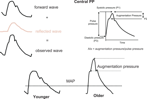 Figure 3 The upper part gives a schematic representation of the BP curve on the right, and the forward and reflected wave on the left. In the lower part, the BP curve is represented in younger (on the left) and in older (on the right) subjects. Augmentation index (AIx) is the ratio between: 1) the difference between peak SBP and the shoulder of the ascending part of the BP curve, and 2) pulse pressure. AIx, measured in %, represents the supplementary increase in SBP due to wave reflections. This hemodynamic profile is observed in the elderly, not in young people. MAP is mean arterial pressure, corresponding to the steady pressure necessary to a continuous cardiac pump.