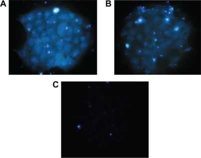 Figure 2 Immunofluorescence staining of A) aldehyde Fe3O4-dextran-anti-β-HCG nanoparticles, B) anti-β-HCG antibody, and C) nonaldehyde Fe3O4-dextran-anti-β-HCG nanoparticle.Abbreviations: Fe3O4, magnetic iron oxide; HCG, human chorionic gonadotropin.
