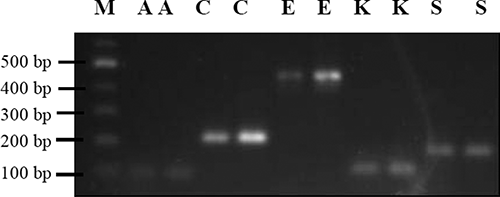 Figure 4. Gel electrophoresis. M = DNA ladder (100 base pairs [bp]), A = A. baumannii (101 bp), C = C. freundii (221 bp), E = E. coli (446 bp), K = K. pneumoniae (119 bp), S = S. aureus (188 bp).