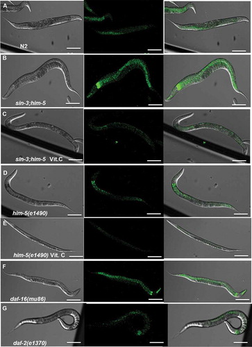 Figure 5. Confocal images of in vivo DCFDA-stained worms. The fluorescence in the pharynx and overall body of the sin-3;him-5 mutant worm (B) is considerably higher than the wild-type N2 (A), him-5(e1490) isogenic control (D) and short lived mutant daf-16(mu86) (F) worms. The high intracellular fluorescence is restored to basal levels after the sin-3;him-5 worms (C) were grown on NGM plates supplemented with 10 mM vitamin C. No significant difference is observed between him-5(e1490) worms grown on NGM plates with (E) and without vitamin C supplementation (D). 20 worms per strain were photographed and the experiment was repeated 3 times. Images were taken at 200X; scale: 20 µm.
