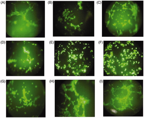 Figure 4. Effect of nanobodies (mono- and oligoclonal mode) on HUVEC cell tube formation. (A) Nb25. (B) Nb30. (C) Nb31. (D) Nb34. (E) Oligoclonal nanobodies. (F) PBS [negative control]. (G) Bevacizumab [positive control antibody]. (H) H39Nb [negative nanobody control]. (I) VEGF [as stimulator of tube formation]. Cells were observed using a fluorescence inverted microscope. Magnification =20×.
