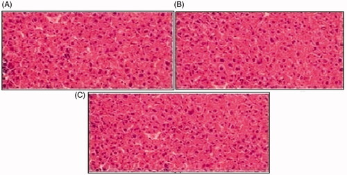 Figure 10. Histological examination of liver of rabbit of control group I (A), after oral solution of 5-FU-MMWCH-NPs treated group II (B) and 5-FU-MMWCH-NPs treated group III (C).