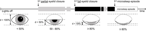 Figure 1 Maintenance of wakefulness tests analysis. Illustration of the different eyelid closure categories and the assessment of eyelid closure behavior during the maintenance of wakefulness test. d = distance, 50–80% = partial eyelid closure (grey shaded block), ≥ 80% = full eyelid closure (black shaded block).