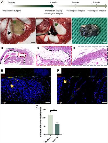 Figure 4 Evaluation of the implantation surgery and pre-vascularization process. (A) Time course of the in vivo experiments and photos of the implantation surgery. The black arrow shows the residual scaffold materials, while the green arrow shows the pre-embedded vessels. (B) Panoramic view of the HE staining of the vascularized scaffolds harvested at week 4. (C) High magnification images of the residual scaffold are marked with blue dotted lines. (D) High magnification images of the central area are marked with red dotted lines. (E) Immunofluorescence images of CD31, α-SMA, DAPI, and merger of the central area. (F) Immunofluorescence images of CD31, α-SMA, DAPI, and merger of the scaffold area. Yellow arrow shows the neovessels. (A scale bar=5mm; B scale bar=200μm; C-F scale bar=50μm). (G) Histogram showing the number of blood vessels/area (mean±SD, **P-value <0.01).