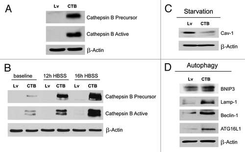 Figure 4. Fibroblasts overexpressing Cathepsin B (CTSB) show a loss of Cav-1 expression, with constitutive activation of the autophagic program. (A) To investigate if stromal cathepsin B expression plays a significant functional role in breast cancer pathogenesis, we overexpressed the CTSB gene in fibroblasts, via lenti-viral transduction. Note that both the CTSB-precursor and activated-cleaved form were observed by immunoblot analysis, in stably transfected hTERT fibroblasts. (B) Cathepsin B expression was also evaluated after 12h and 16h of starvation (in Hepes-buffered HBSS). Note that CTSB continued to accumulate during starvation, consistent with its stabilization within lysosomes, during autophagy. (C) We also evaluated Cav-1 expression after overnight starvation. As expected, we detected a strong reduction in Cav-1 protein levels, validating the connection between autophagy and loss of Cav-1 protein expression. (D) Immunoblot analysis of CTSB fibroblasts demonstrated that cathepsin B overexpression is sufficient to drive the induction of autophagy. Note that cathepsin B overexpression strongly induces several autophagy/mitophagy markers (BNIP3, Lamp1, Beclin1 and ATG16L1). In all panels, β-actin expression was assessed as a control for equal protein loading. Lv- represents fibroblasts transduced with the vector alone control, namely Lv-105 (puro).