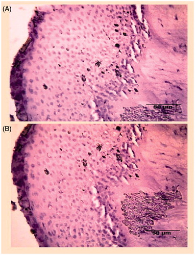 Figure 6. Digital optical microscopy image of excised goat cornea. (A) Control solution and (B) nanoformulation at 10–40×. The corneal tissue exhibited no change in cellular structure and morphology of normal cell.