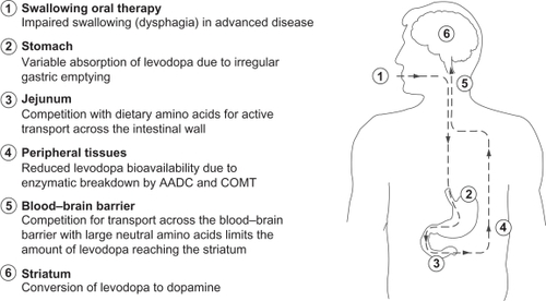 Figure 3 Oral levodopa therapy – hurdles on the route from the mouth to the brain. A number of factors impact on the progress of levodopa from the time of ingestion until it reaches the brain and is converted to dopamine.