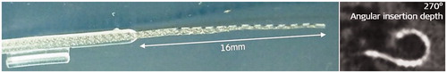 Figure 40. Short electrode array with 16 mm length to cover up to 270° of angular insertion depth. Image courtesy of MED-EL.